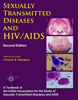 Sexually Transmitted Diseases and Hiv Aids 2nd Edition