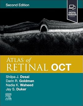 Atlas of Retinal OCT Optical Coherence Tomography