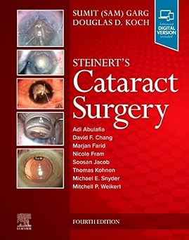 Steinerts Cataract Surgery