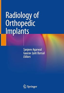Radiology of Orthopedic Implants