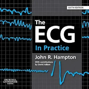 The ECG In Practice 6th Edition By John Hampton