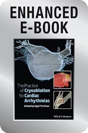 The Practice of Catheter Cryoablation for Cardiac Arrhythmias