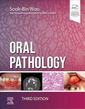 Oral Pathology 3rd Edition