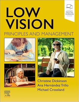 Low Vision Principles and Management