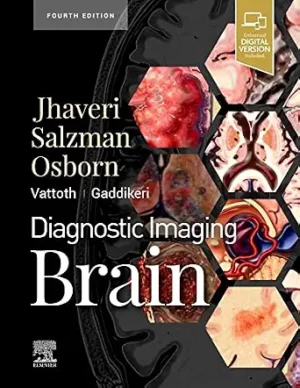 Diagnostic Imaging Brain