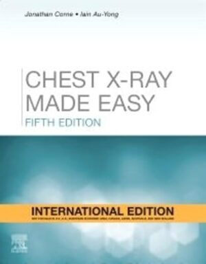 Chest X Ray Made Easy 5th Edition