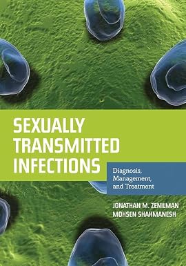 Sexually Transmitted Infections Diagnosis Management and Treatment