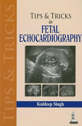 Tips & Tricks in Fetal Echocardiography