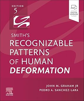 Smiths Recognizable Patterns of Human Deformation