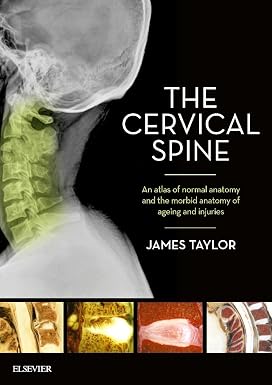 The Cervical Spine An atlas of normal anatomy and the morbid anatomy of ageing and injuries