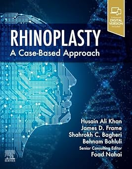 Rhinoplasty a Case based approach
