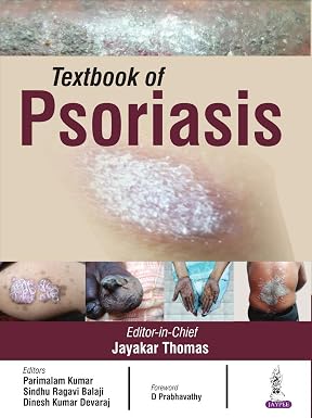 Textbook of Psoriasis 2nd Edition