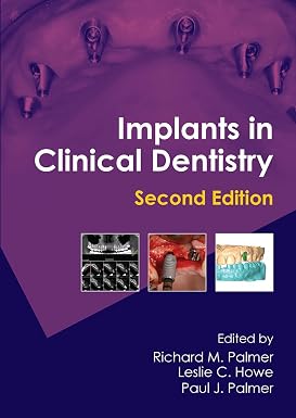 Implants in Clinical Dentistry 2nd Edition