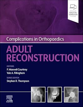 Complications in Orthopaedics Adult Reconstruction
