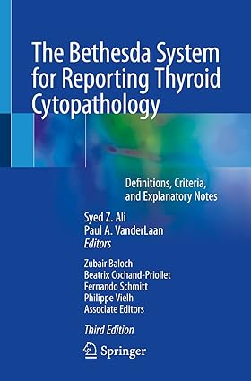 The Bethesda System for Reporting Thyroid Cytopathology Definitions Criteria and Explanatory Notes