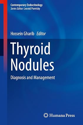 Thyroid Nodules Diagnosis and Management