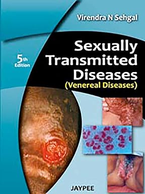 Sexually Transmitted Diseases 5th Edition
