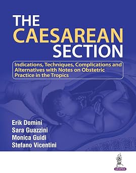 The Caesarean Section