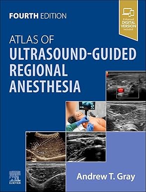 Atlas of Ultrasound Guided Regional Anesthesia
