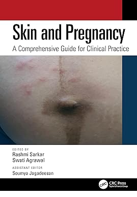 Skin and Pregnancy A Comprehensive Guide for Clinical Practice