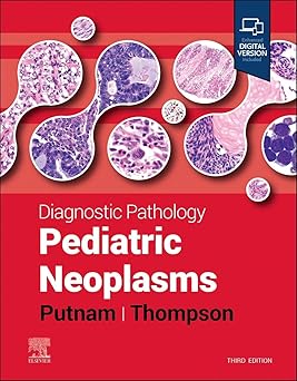 Diagnostic Pathology Pediatric Neoplasms