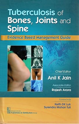 Tuberculosis of Bones Joints and Spine Evidence Based Management Guide