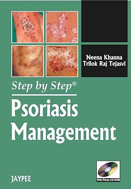 Step by Step Psoriasis Management
