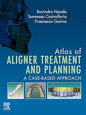 Atlas of Aligner Treatment and Planning A Case Based Approach