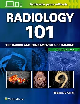 Radiology 101 The Basics and Fundamentals of Imaging