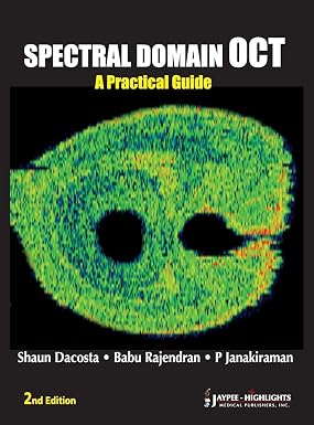 Spectral Domain OCT A Practical Guide