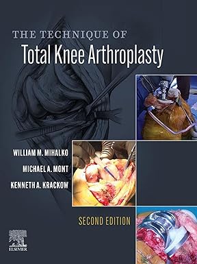 The Technique of Total Knee Arthroplasty E Book