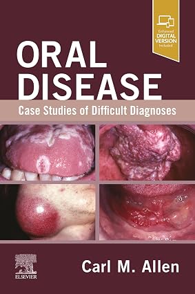 Oral Disease Case Studies of Difficult Diagnoses  E Book