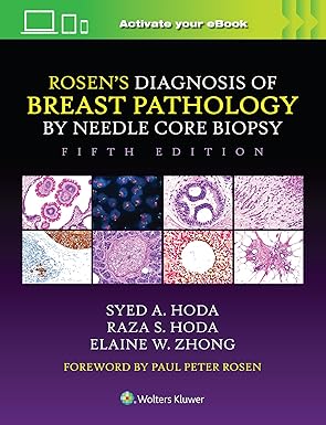 Rosens Diagnosis of Breast Pathology by Needle Core Biopsy