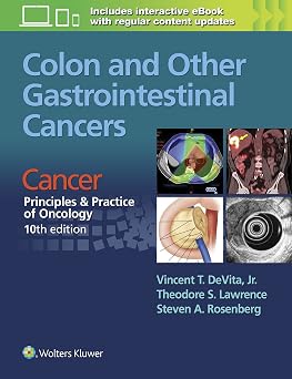 Colon and Other Gastrointestinal Cancers Cancer Principles & Practice of Oncology 10th Edition