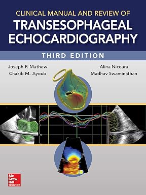 Clinical Manual and Review of Transesophageal Echocardiograph 3rd Edition