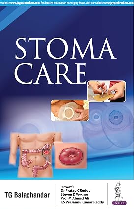 Stoma Care By Tg Balachandar