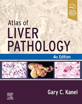 Atlas of Liver Pathology E Book