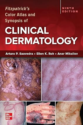 Fitzpatricks Color Atlas and Synopsis of Clinical Dermatology 9th Edition
