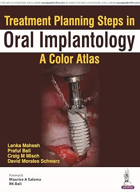 Treatment Planning Steps in Oral Implantology A Color Atlas