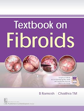 Textbook on Fibriods