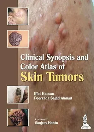 Clinical Synopsis and Color Atlas of Skin Tumors