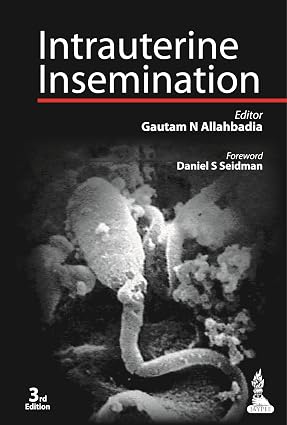 Intrauterine Insemination 2nd Edition