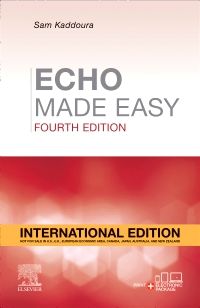 Echo Made Easy 4th Edition