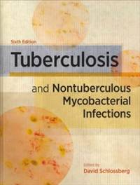 Tuberculosis and Nontuberculous Mycobacterial Infections