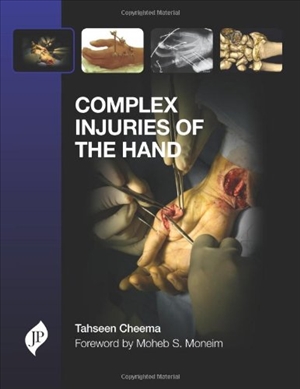 Complex Injuries of the Hand