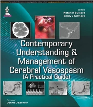 Contemporary Understanding and Management of Cerebral Vasospasm A Practical Guide