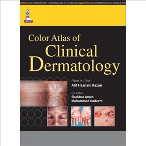 Color Atlas of Clinical Dermatology