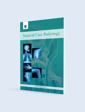 Surgical Case Radiology By Shireen Ramazan Ali