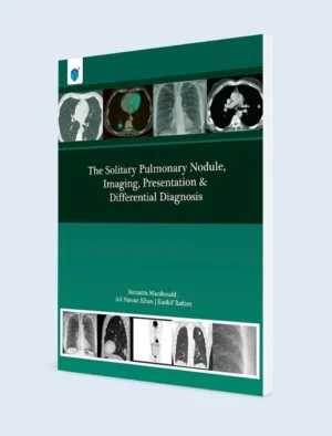The Solitary Pulmonary Nodule Imaging Presentation & Diff Diagnosis