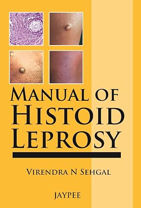 Manual of Histoid Leprosy